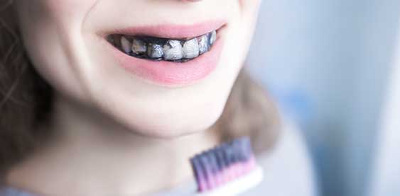como se hace el carbón activado - clínica dental sorias