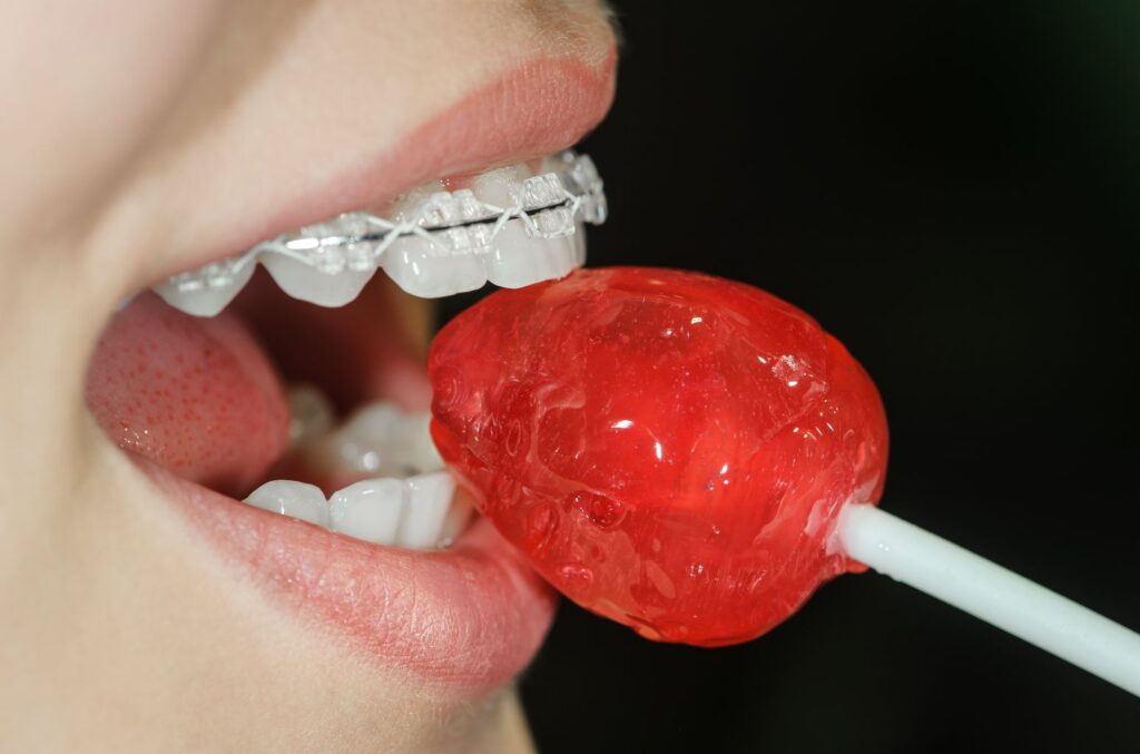 higiene dental ortodoncia - clínica dental sorias