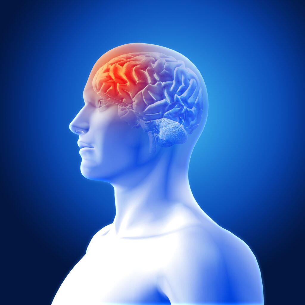 Clínica Dental Sorias - Blog - La posible relación entre el dolor de cabeza y el dolor de muelas - Dolor de cabeza en vista de cerebro