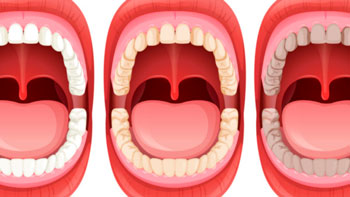 manchas-blog-clinicas-sorias