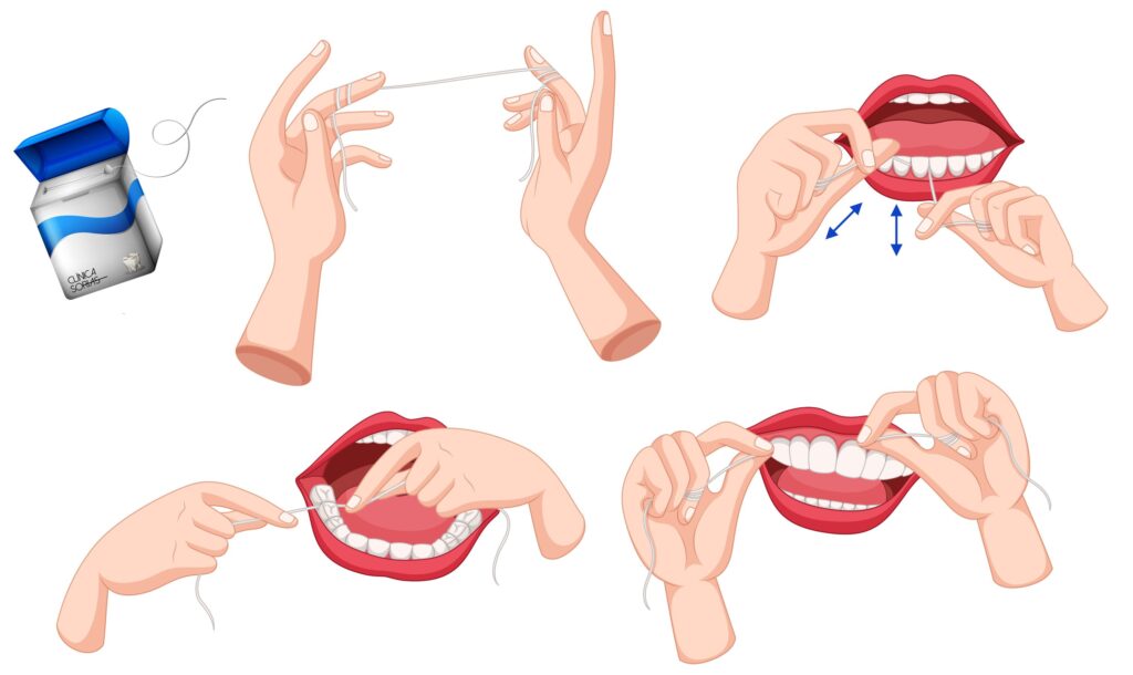 Clínica Dental Sorias - Blog - El uso del hilo dental - Proceso de limpieza con hilo dental