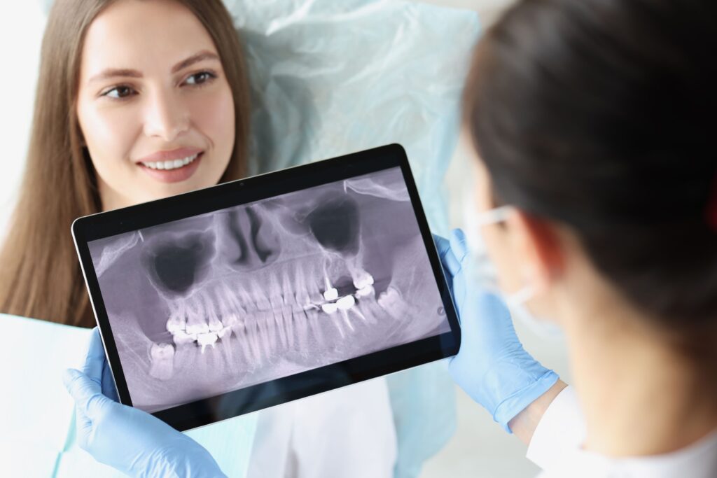 Clínica Dental Sorias - Blog - Oclusión dental - Radiografía dentadura