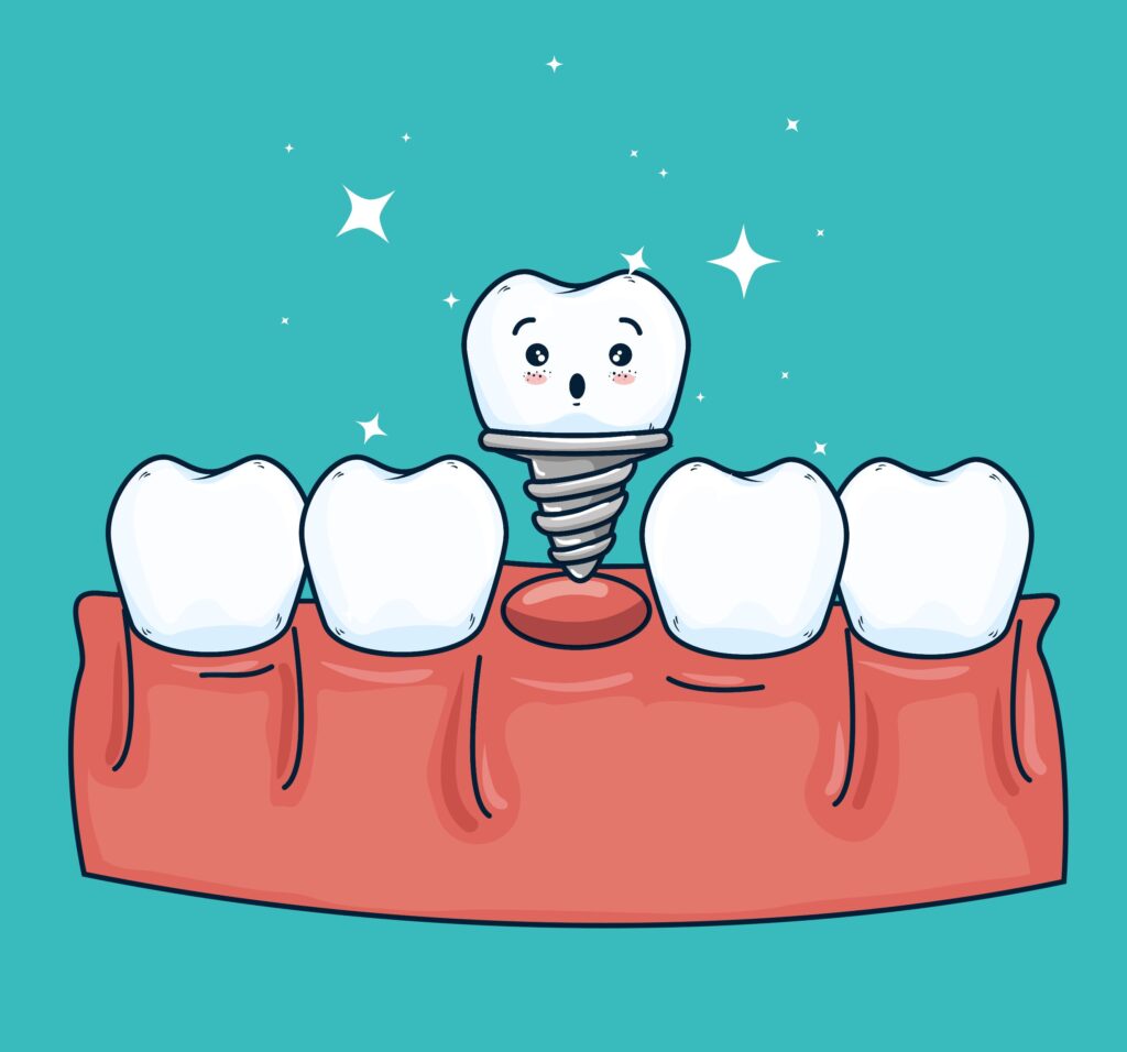 Clínica Dental Sorias - Blog - Implantes dentales: Una guía completa para resolver dudas - Implante feliz