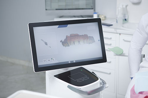 imagen-3D-escaner-intraoral-blog-clinica-soria