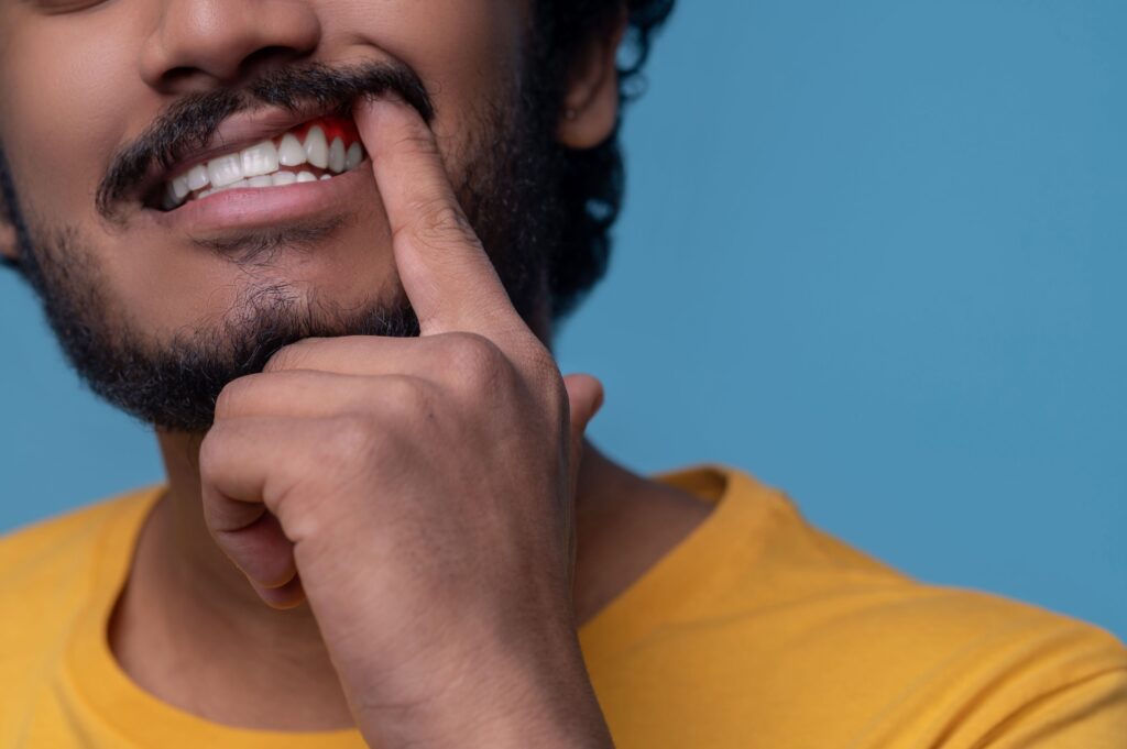 porque sangran las encías - clínica dental sorias
