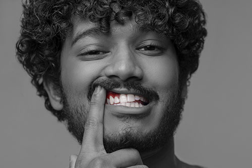 gingivectomia-blog-clinica-soria