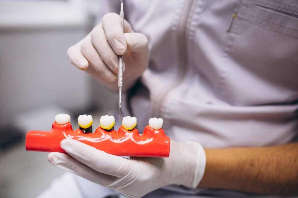 dentista enseñando efectos de la periodontitis en una dentadura de muestra