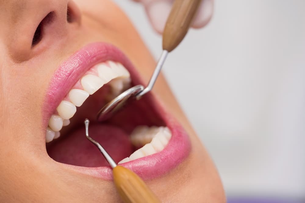 visita al dentista caries Clínica Sorias