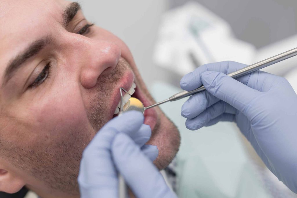 Paciente arreglando diente roto en el dentista