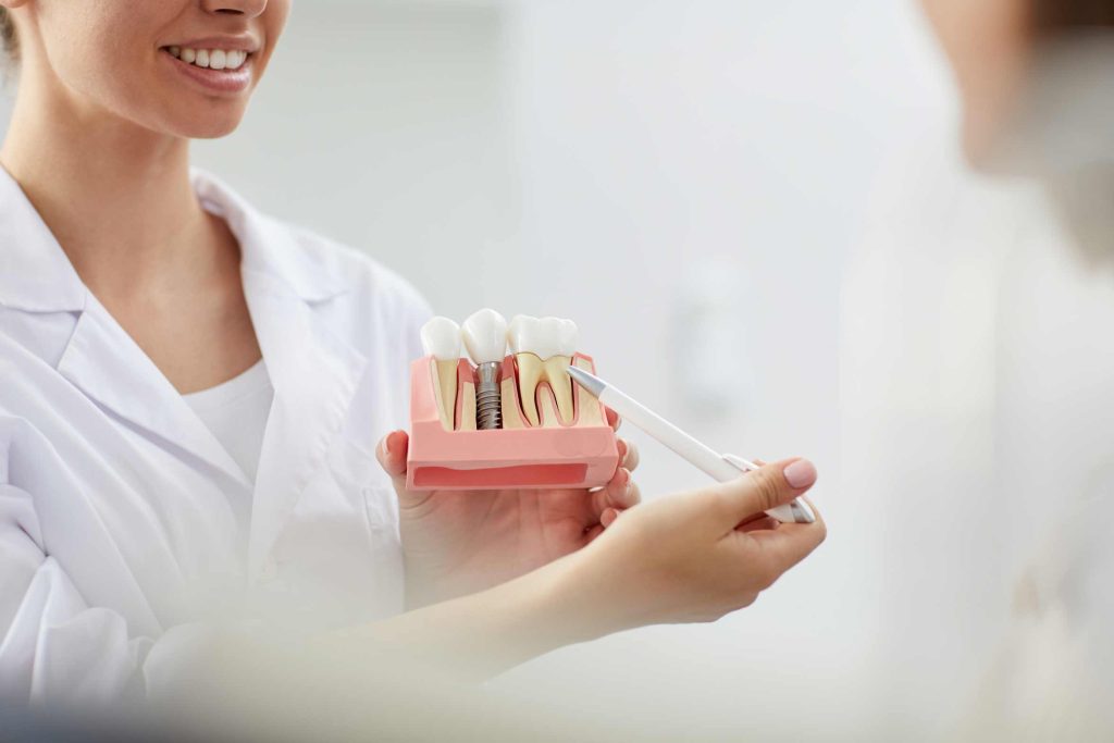 Dentista explicando qué es un implante dental