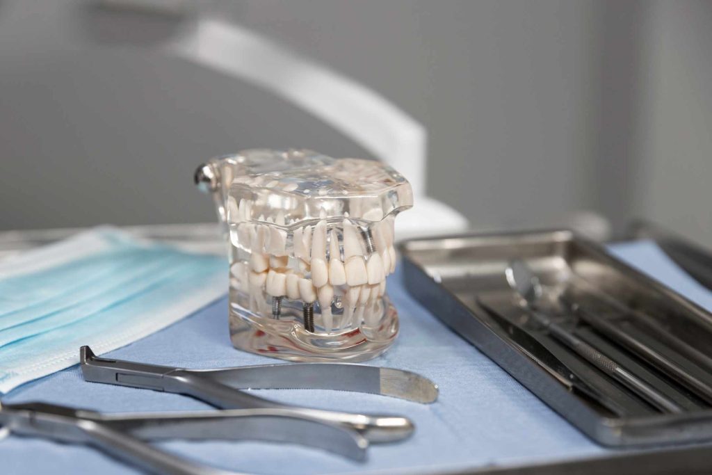 Instrumentos de odontología con una mandíbula con implantes dentales