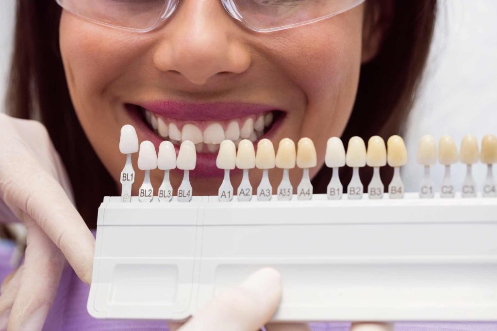 Mujer paciente eligiendo entre diferentes tipos de carillas dentales